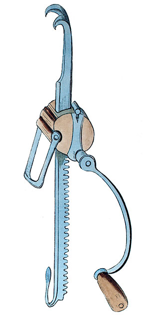 Cranequin (ou Tournique) - Gravure  reproduite puis restaurée numériquement par © Norbert Pousseur